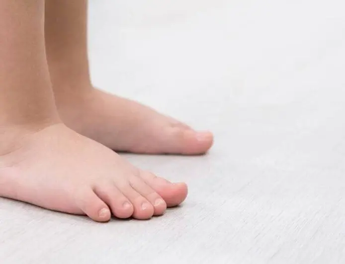 8 ورزش‌ اصلاحی معجزه آسا برای درمان کف پای صاف کودکان