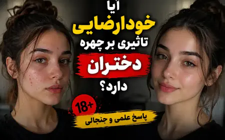 خودارضایی در چهره دختران آیا باعث جوش می‌شود؟