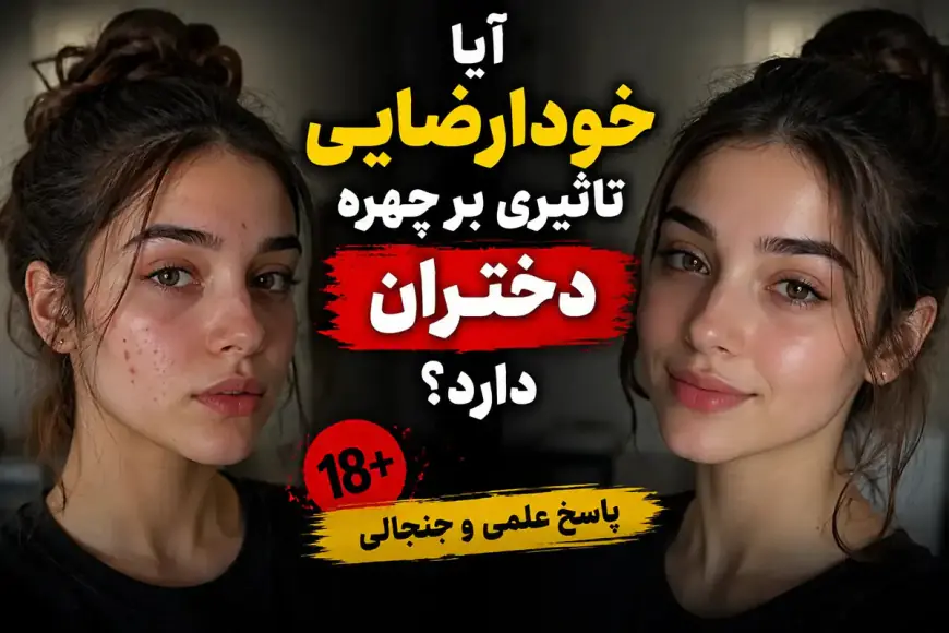 خودارضایی در چهره دختران آیا باعث جوش می‌شود؟